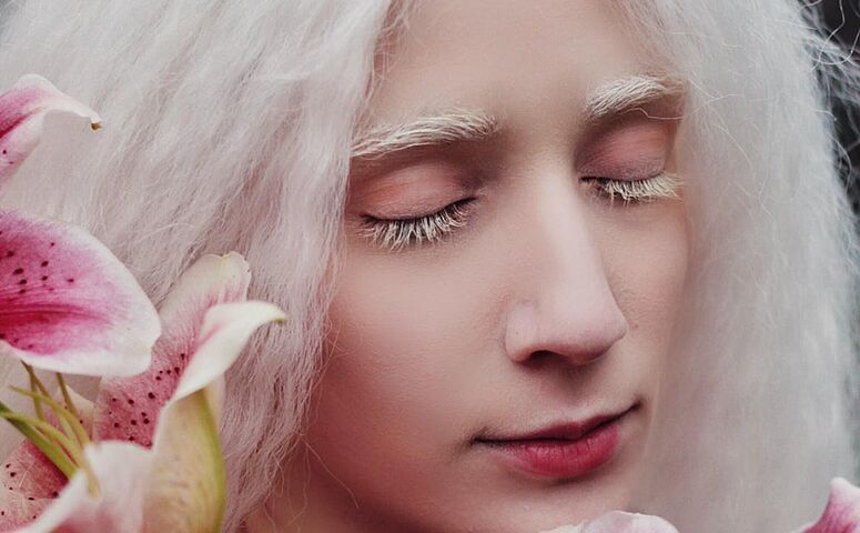 Intervju sa Albino Girl Sumi